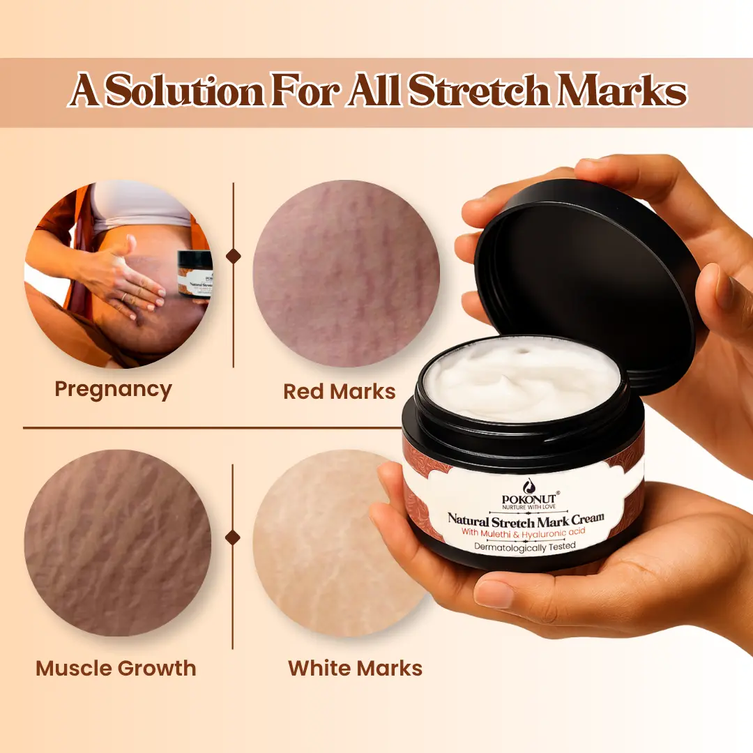 Pokonut Stretch Mark Cream - Image 4
